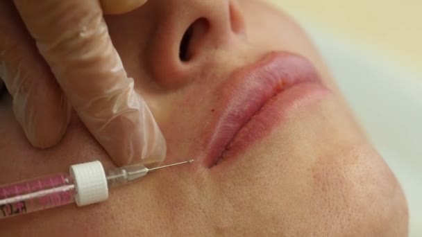 Kosmetolog göra injektion i kvinnans läppar. Lip augmentation och plastikkirurgi. 4k — Stockvideo