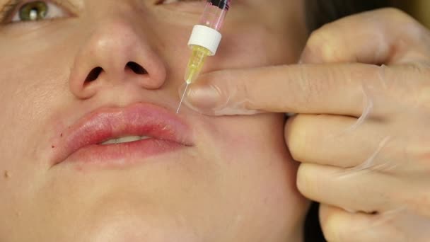 Processen att lip augmentation av hyaluronsyra. patienten under läppar injektion. slowmotion — Stockvideo