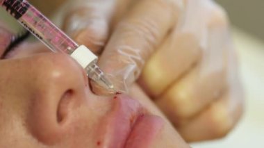 güzellik uzmanı kadının dudakları içine enjeksiyon yapmak. dudak büyütme ve plastik cerrahi. 4k