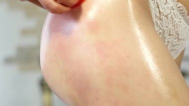 kadının yapması Anti-Selülit vakum Masaj Terapisi onun kalça, evde kendi kendine masaj. 4k