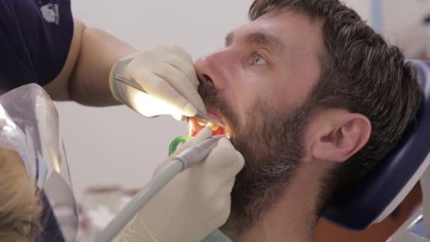 Vrouwelijke tandarts trakteert tanden op mannelijke patiënt. Stomatoloog behandelt cariës in de tanden van patiënten. Procedure voor mondhygiëne in de tandheelkunde — Stockvideo