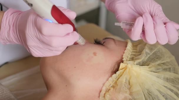 Cosmetologie procedure van ouderdomsvlekken verwijderen in cosmetologie kliniek. Concept gezichtsverzorging. — Stockvideo