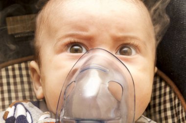 Grip için tıbbi solunum Inhalator maskesi buharı dikiş tedavi kullanarak bebek. Yeni doğan
