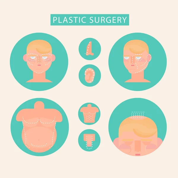 Ensemble d'icônes plates de chirurgie plastique — Image vectorielle