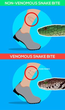Zehirli ve sigara zehirli yılan ısırığı bacağından. Yılan sokması. Yılanlar ile dikkatli olun. Düz vektör çizimler