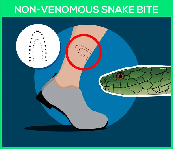 Mordedura de serpiente no venenosa en la pierna. Mordedura de serpiente. Cuidado con las serpientes. Ilustraciones de vector plano — Archivo Imágenes Vectoriales