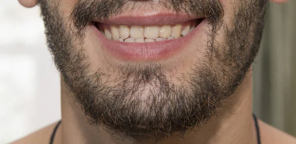 De bebaarde man glimlacht, slechte tanden tonen. — Stockfoto