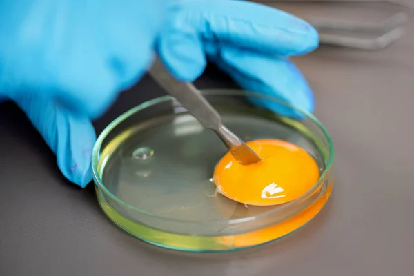 Лабораторные исследования кала. Методы исследования яиц. Экспертиза пищевых продуктов. Безопасность пищевых продуктов. Исследование яиц в лаборатории.