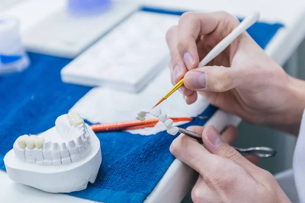 Zahntechniker Oder Zahnarzt Der Seinem Labor Mit Zahnersatz Arbeitet — Stockfoto