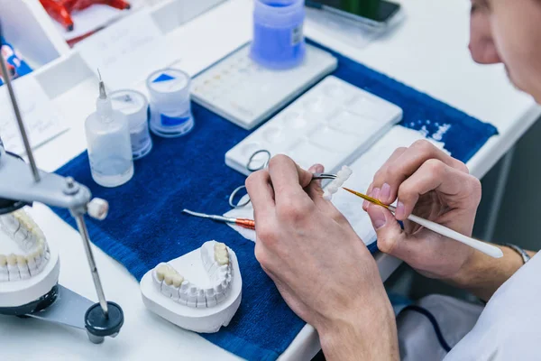 Técnico Dentário Dentista Que Trabalha Com Próteses Dentárias Seu Laboratório — Fotografia de Stock