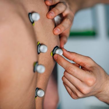 Yansıtıcı işaretleme fizyoterapist yerleştirerek topları duruş analizi için