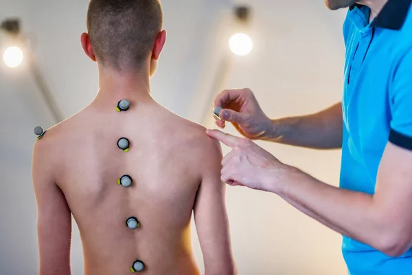 Physiotherapeut Platziert Jungen Mit Markierungsbällen Für Haltungsanalyse Fitnessstudio — Stockfoto