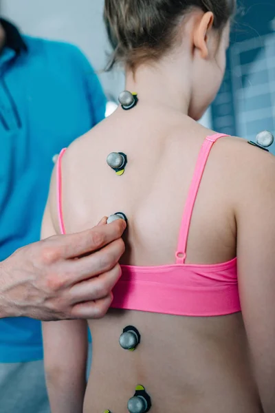 Fisioterapeuta Colocando Bolas Marcação Reflexiva Para Análise Postural — Fotografia de Stock