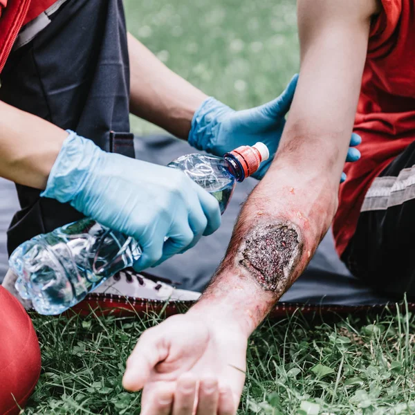 Woman Doing First Aid Paramedic Training Treating Third Degree Burns — Stock Photo, Image