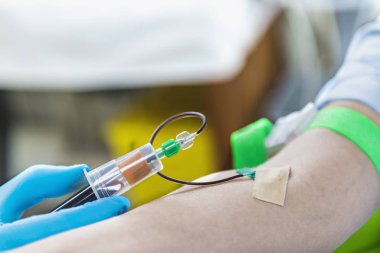 Trombosit zengini plazma yüz tedavisi için kan alınıyor. Doktorun elinde mavi ameliyat eldiveni Prp yüz estetik tedavisi için kan alıyor.. 