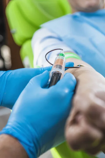 Rysowanie Krwi Leczenia Twarzy Bogatej Płytki Krwi Ręka Lekarza Niebieskiej — Zdjęcie stockowe