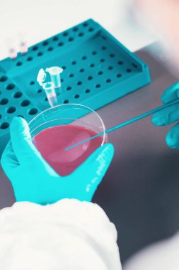 Mikrobiyoloji, Petri yemekler ile çalışma