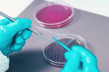 Petri dish, teftiş mikrobiyolog bakteri büyüme gözlemleyerek