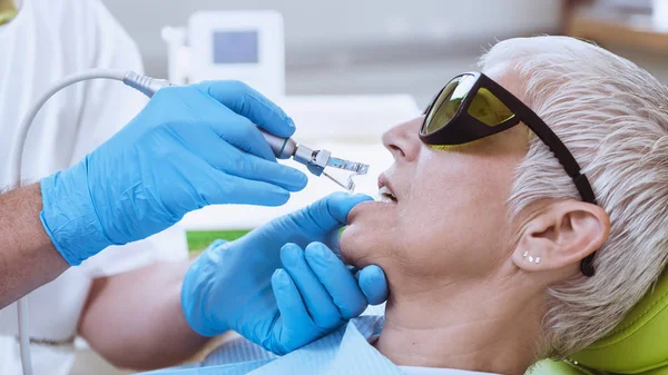 Wybielanie Zębów Laserowych Portret Starszej Kobiety Odwiedzającej Dentystę Wybielanie Zębów — Zdjęcie stockowe