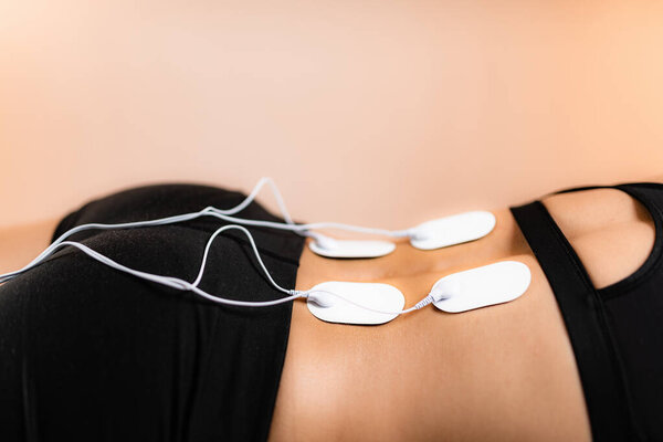 Lower Back Physical Therapy with TENS Electrode Pads, Transcutaneous Electrical Nerve Stimulation. Electrodes onto Patient's Lower Back