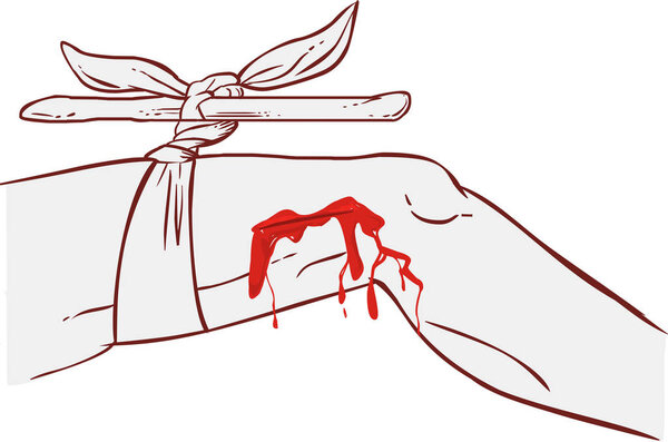 остановить кровоток на ноге куском дерева, применяя
 