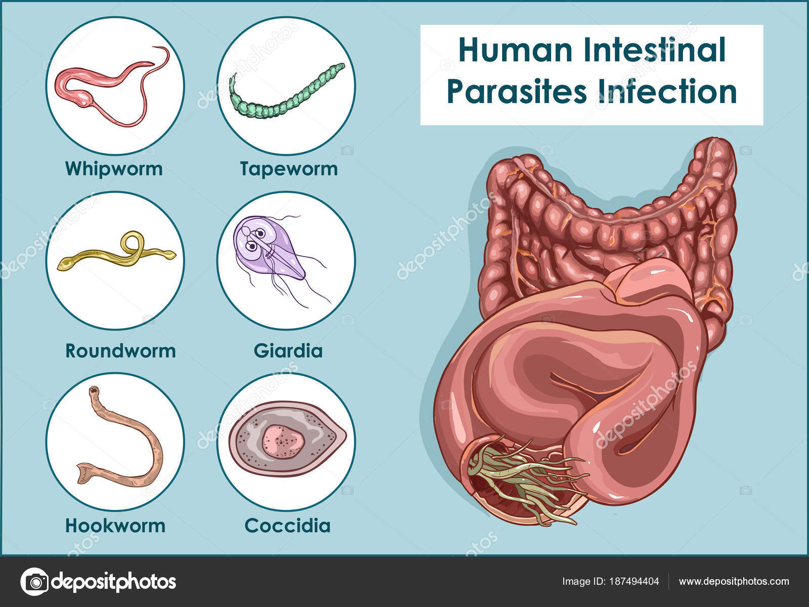 gyógyszerek a bél helminthiasis kezelésére körömférgek fertőzőek