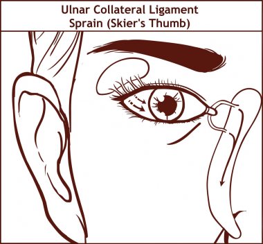 Vector illutration, anatomy of the Lacrimal apparatus clipart