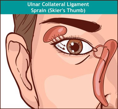 vektör İllüstrasyonu, lakrimal aparatı anatomisi