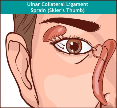 Vector illutration, anatomy of the Lacrimal apparatus clipart