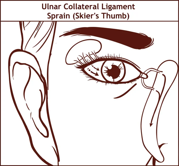 Vector illutration, anatomie van het lacrimale apparaat — Stockvector