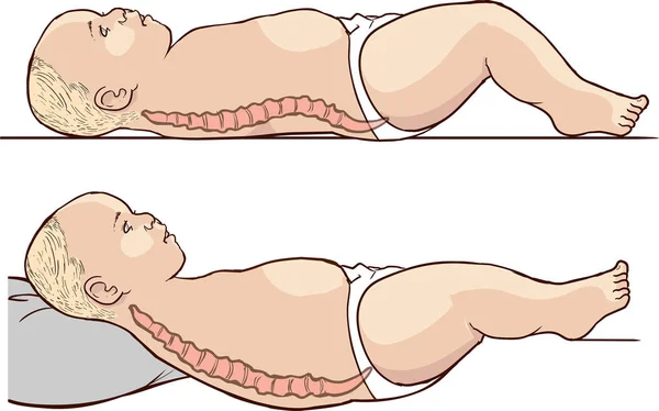 婴儿脊椎图解及正确的躺姿 — 图库矢量图片