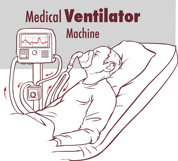 Equipos Máquinas Médicas Ventilación Para Traqueostomía Respiración Del Paciente Quirófano — Archivo Imágenes Vectoriales