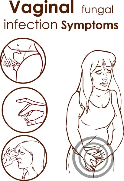 Vaginale Schimmelinfectie Symptomen Vector Illustratie — Stockvector