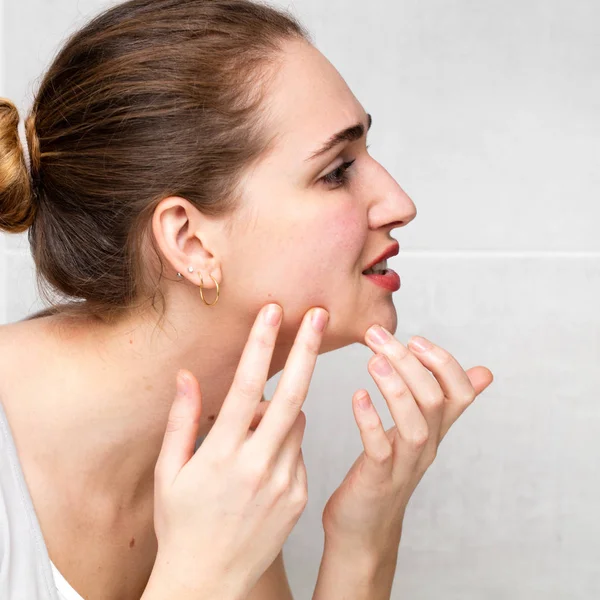 Female teenager with acne checking her zits, pimples or blemishes — Stock Photo, Image