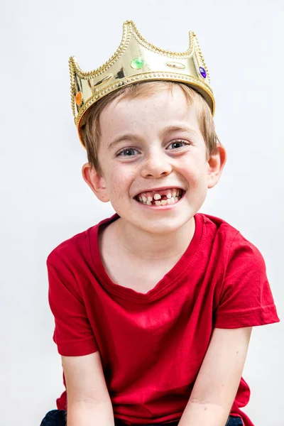 Sonriente hermoso chico con corona de oro y diente faltante posando — Foto de Stock