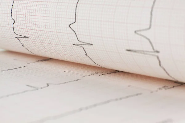 EKG kalp sayfa — Stok fotoğraf