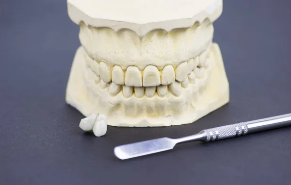 Moldeo Dental Que Ilustra Industria Dental Implantología Dental Imágenes De Stock Sin Royalties Gratis