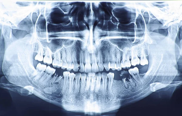 High resolution panoramic dental radiography