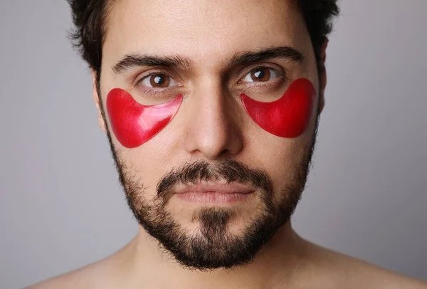 Close up retrato de homem barbudo com manchas hidratantes sob os olhos. Isolados . — Fotografia de Stock