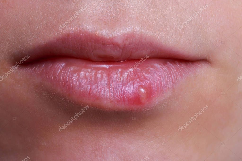 Dudaklardagi xoroz Dudaklardagi xoroz
