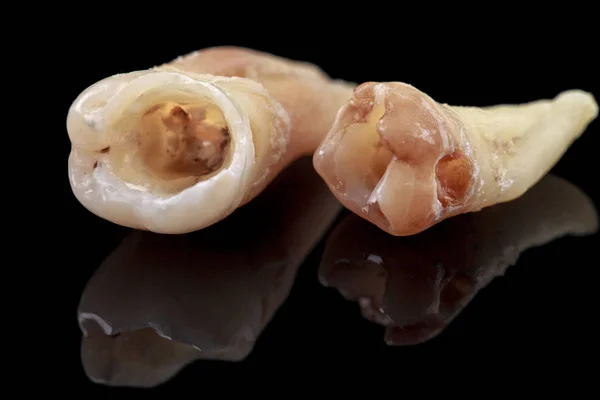 Os dentes removidos danificados pela cárie em um fundo preto. Macro . — Fotografia de Stock