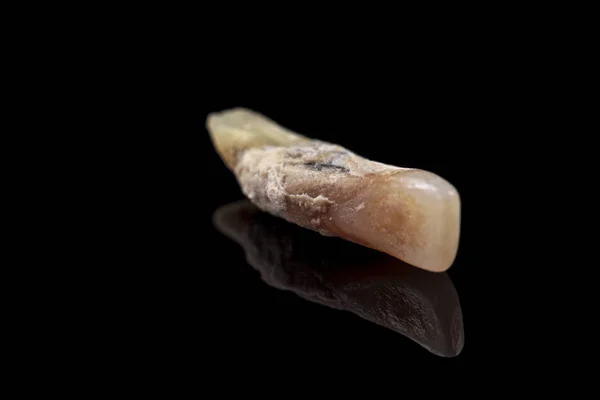 O dente remoto é danificado por cárie em um fundo preto. Macro . — Fotografia de Stock