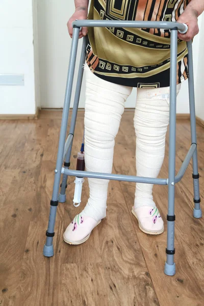 An elderly woman after an operation of endoprosthetics.