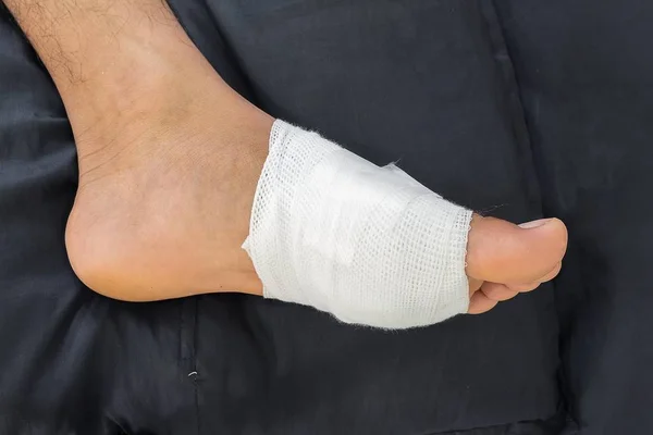 Αρσενικό είναι συσκευασία του τραυματισμού στο πόδι με επίδεσμο — Φωτογραφία Αρχείου