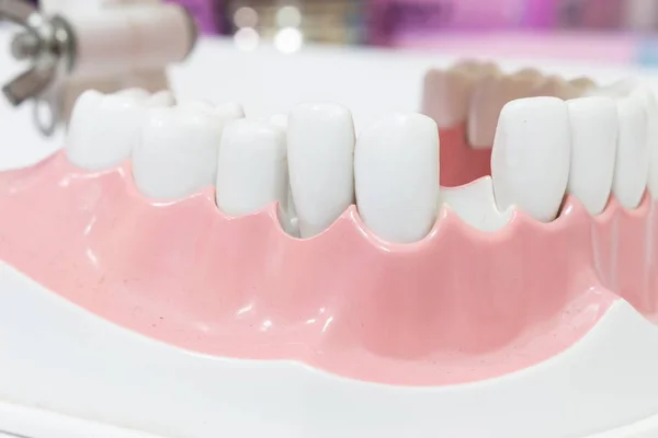 Closeup Dental Model of Teeth  dentist. — Stock Photo, Image