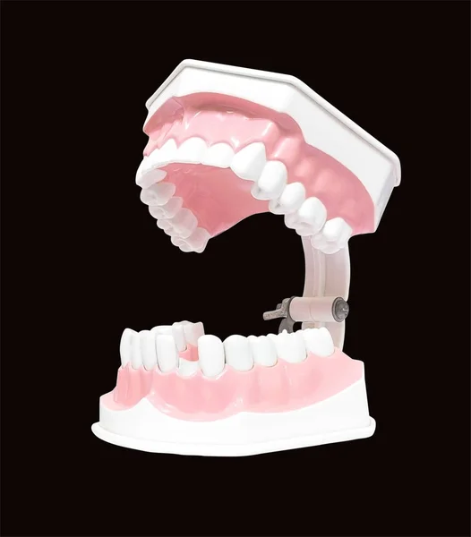 Modelo dentário de dentes — Fotografia de Stock