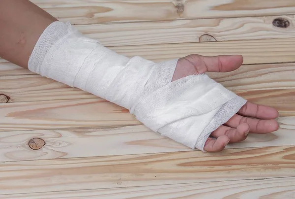 Gauze bandage the hand contusion. treating patients with hand — Stock Photo, Image