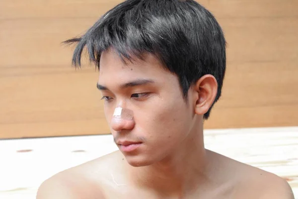 Штукатурка на молодому чоловікові рана носа — стокове фото