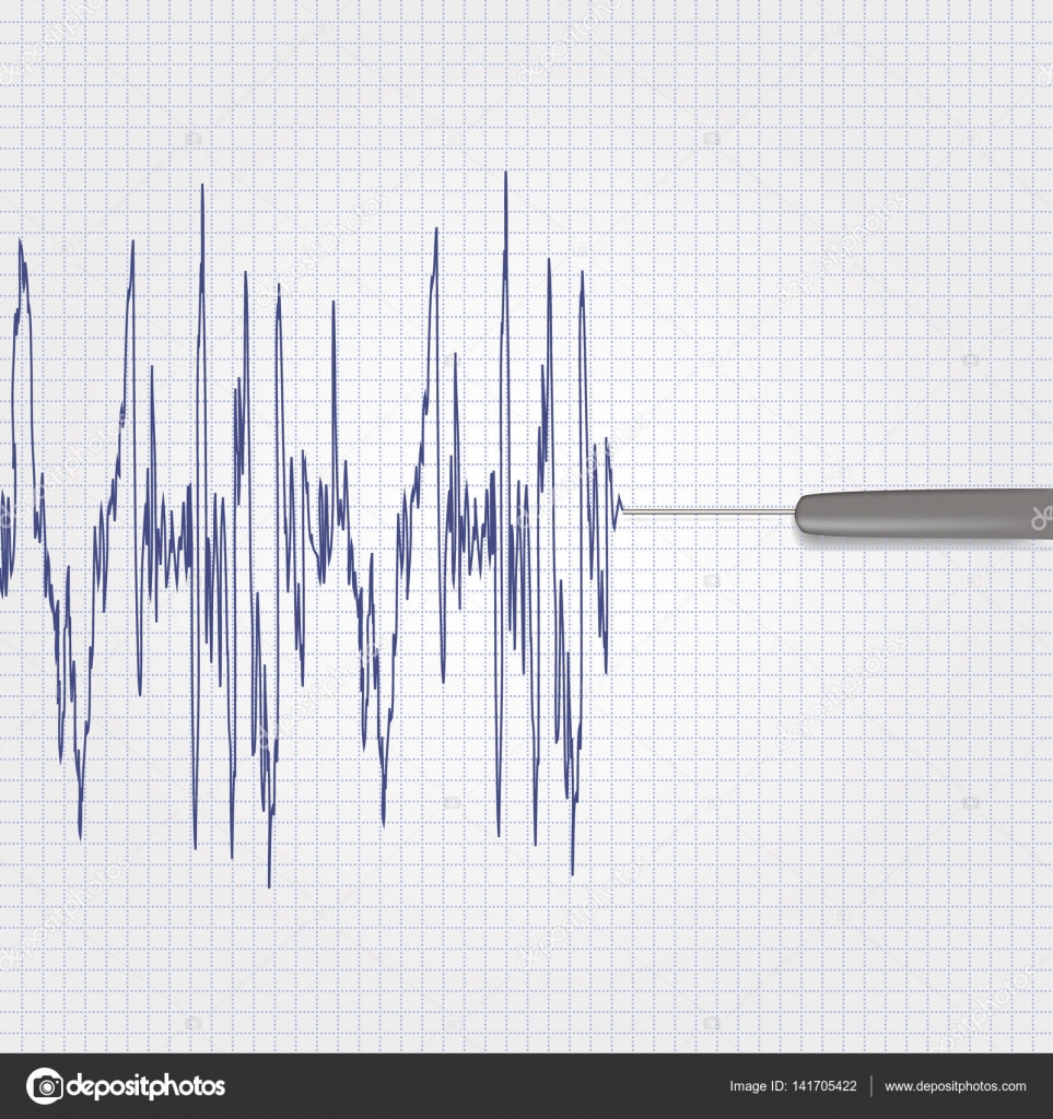 Polygraph Chart Markings