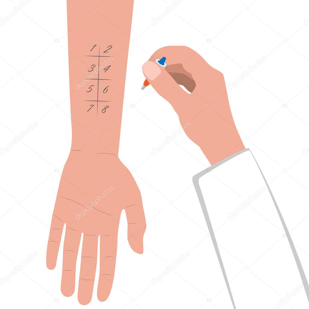 Allergy test. Hand with pipette. Medical research flat design. Patient with an allergic reaction. Vector illustration